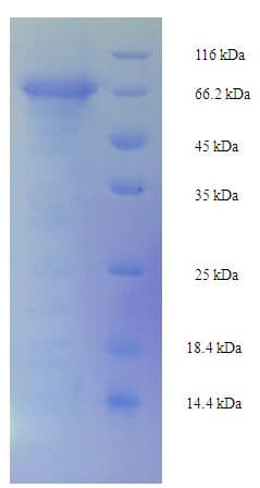 Mouse GP2 Protein (Recombinant His-SUMO)