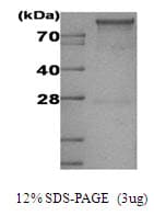 Human HK1 / Hexokinase 1 Protein (Recombinant His)