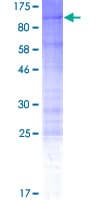 Human ESCO2 Protein (Recombinant GST)
