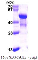 Human NDE1 Protein (Recombinant His)