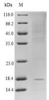 Human GLP1R / GLP-1 Receptor Protein (Recombinant 6His, N-terminus)