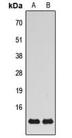 MRPS21 Antibody (Internal)