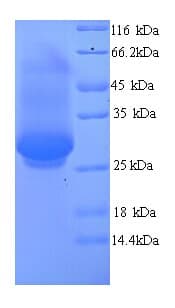Human DNM1 / Dynamin Protein (Recombinant His)