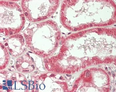 IHC-plus™ Polyclonal Rabbit anti-Human ZFP36L1 Antibody (Internal, IHC, WB)