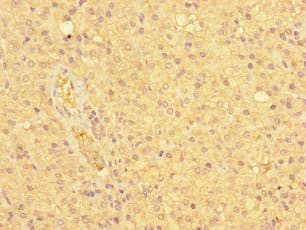 HEC1 / NDC80 Antibody