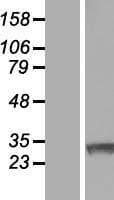 RNF138 Protein (Over-Expression Lysate Myc-DDK (Flag))