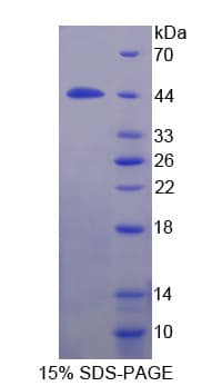 Mouse IL12RB1 / CD212 Protein (Recombinant His-GST-S)