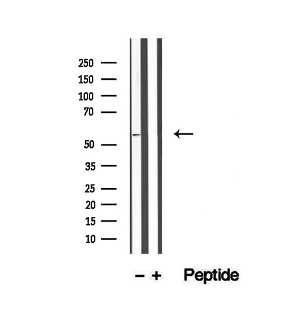 Polyclonal Rabbit anti-Human WSB1 Antibody (IHC, IF, WB)