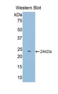 PABPC1L Antibody (aa187-368)