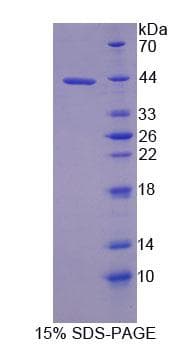 Rat UQCRB Protein (Recombinant His-GST, N-terminus)