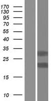 TMX2 / TXNDC14 Protein (Over-Expression Lysate Myc-DDK (Flag))