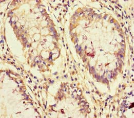 Polyclonal Rabbit anti-Human NCOA6 / ASC-2 Antibody (IHC)