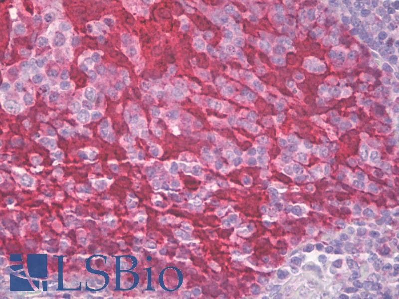 IHC-plus™ SFN / Stratifin / 14-3-3 Sigma Antibody (aa120-170)
