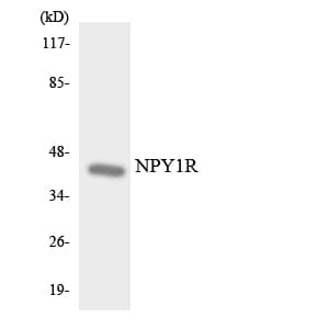 Polyclonal Rabbit anti-Human NPY1R Antibody (aa205-254, WB)