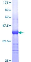Human HDAC6 Protein (Recombinant GST, N-terminus)