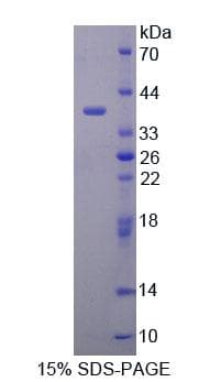 Human MYB / c-Myb Protein (Recombinant 6His, N-terminus)