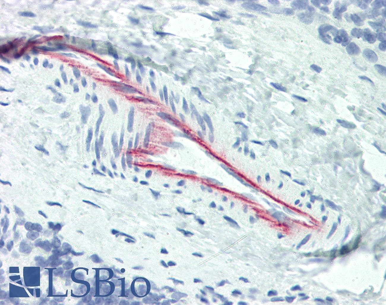 IHC-plus™ HSPG2 / Perlecan Antibody (clone A71)
