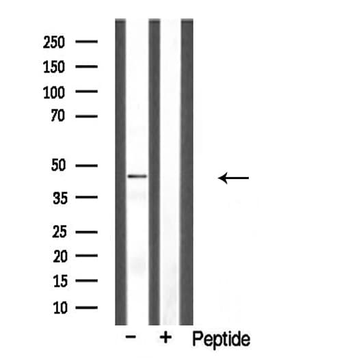 CLN5 Antibody