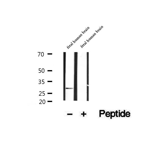 RHOE / RND3 Antibody