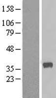 CALHM2 Protein (Over-Expression Lysate Myc-DDK (Flag))