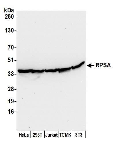 Polyclonal Rabbit anti-Human RPSA / Laminin Receptor Antibody (aa245-295, WB)
