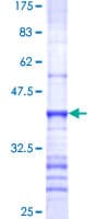 Human MUC4 Protein (Recombinant GST, N-terminus)