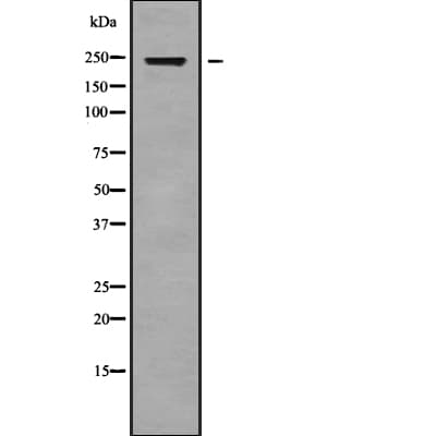 CABIN1 Antibody