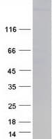 Human MYHC / MYH6 Protein (Recombinant Myc-DDK (Flag))