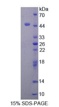 Human TTF1 / Txn Termination Factor Protein (Recombinant His-GST, N-terminus)