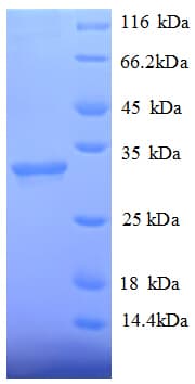 Human HDAC7 Protein (Recombinant His)