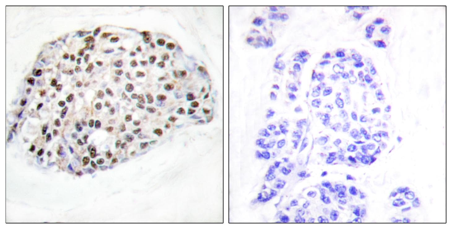 Polyclonal Rabbit anti-Human HDAC1 Antibody (p421, IHC, WB)