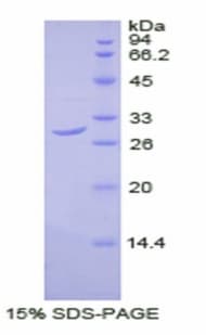 Human DLAT / PDC-E2 Protein (Recombinant His, N-Terminal)