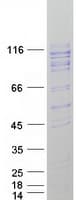 Human ITIH4 Protein (Recombinant Myc-DDK (Flag))