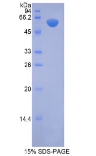 Mouse NAGLU Protein (Recombinant His-GST)