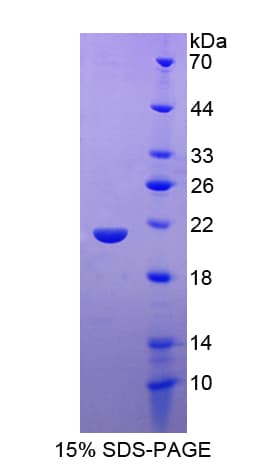 Bovine HBB / Hemoglobin Beta Protein (Recombinant His-T7)