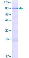Human CHMP7 Protein (Recombinant GST)