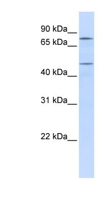 CSA / ERCC8 Antibody (aa72-121)