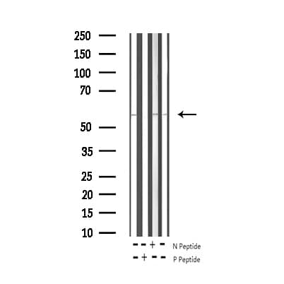 TH / Tyrosine Hydroxylase Antibody (phospho-Ser31)