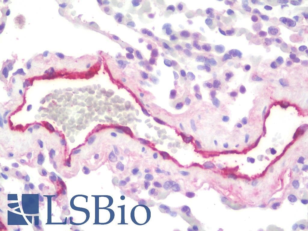 IHC-plus™ VWF / Von Willebrand Factor Antibody