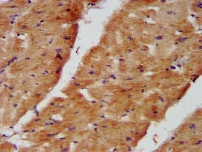 NDUFB8 Antibody