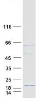 Human CDRT4 Protein (Recombinant Myc-DDK (Flag))