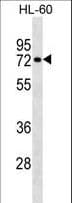 RHOT2 Antibody (aa291-320)