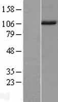NAA16 / NARG1L Protein (Over-Expression Lysate Myc-DDK (Flag))