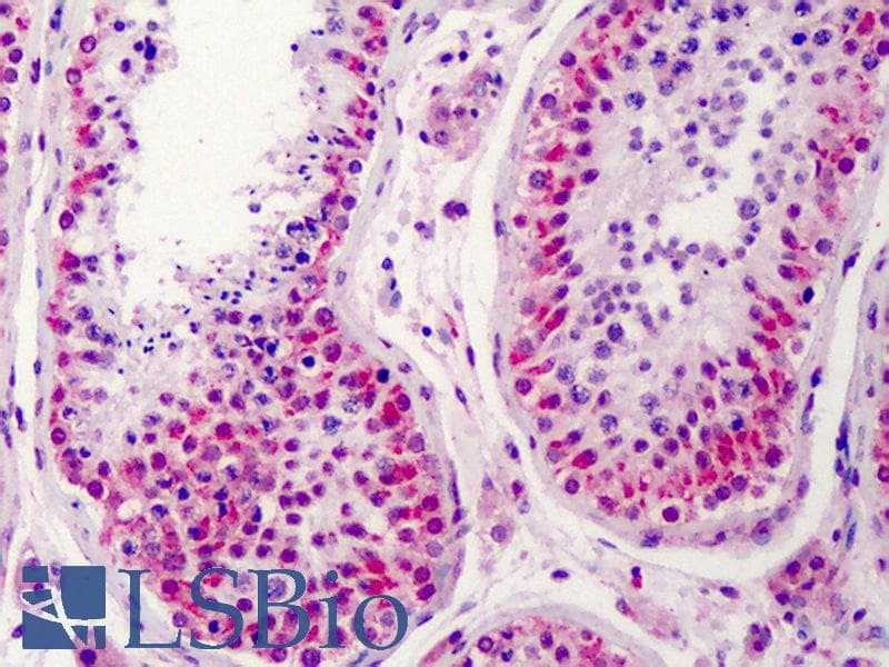 IHC-plus™ Polyclonal Rabbit anti-Human NEK2 Antibody (IHC, IF, WB)