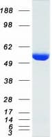 Human G6PD Protein (Recombinant Myc-DDK (Flag))