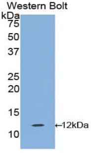 IL1R1 Antibody (aa120-208)