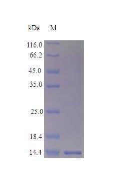 Human LGALS1 / Galectin 1 Protein (Recombinant)
