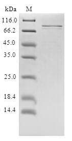 Human PRLR / Prolactin Receptor Protein (Recombinant 10His, N-terminus + Myc, C-terminus)