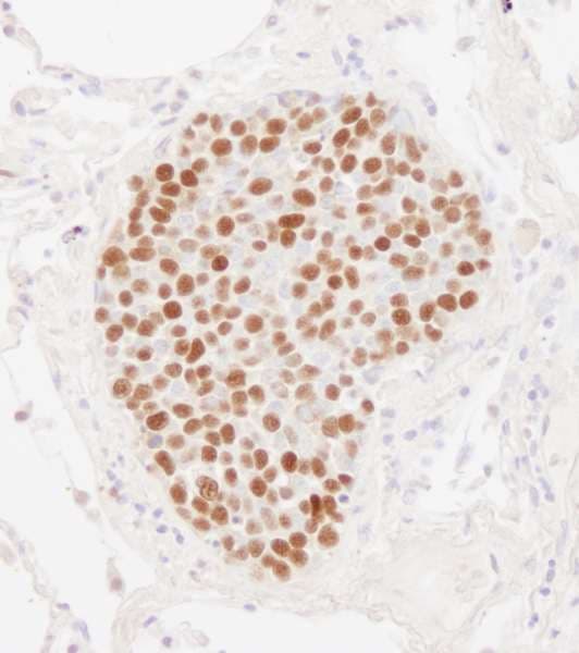 PathPlus™ Polyclonal Rabbit anti-Human MCM2 Antibody (aa1-50, IHC, WB)