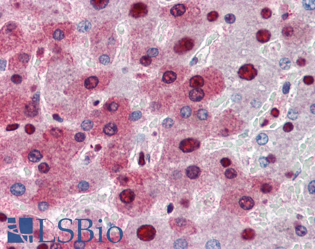 IHC-plus™ NPM1 / NPM / Nucleophosmin Antibody (aa81-294, clone 5E3)
